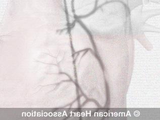 angiogram illustration